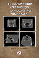 Endoskopik Sins Cerrahisi İin Paranazal Sins Tomografisi